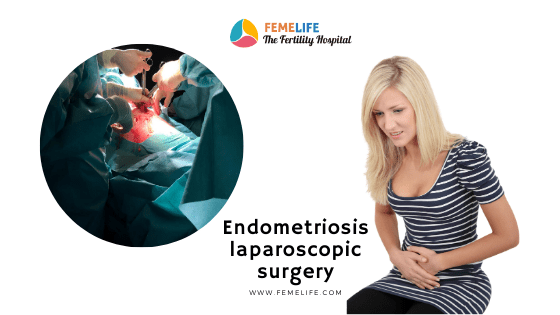 Endometriosis laparoscopic surgery
