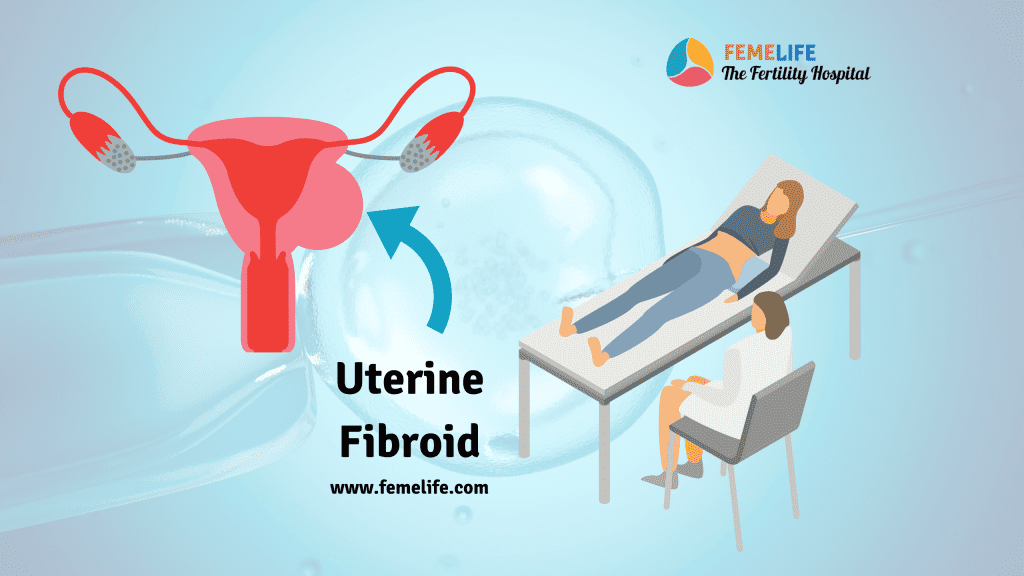 Uterine Fibroid Size