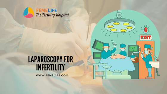 laparoscopy for Infertility