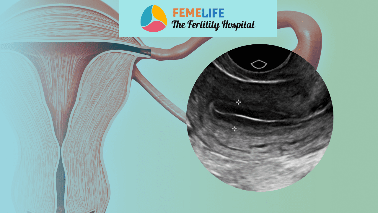 endometrium-thickness-for-pregnancy-femelife