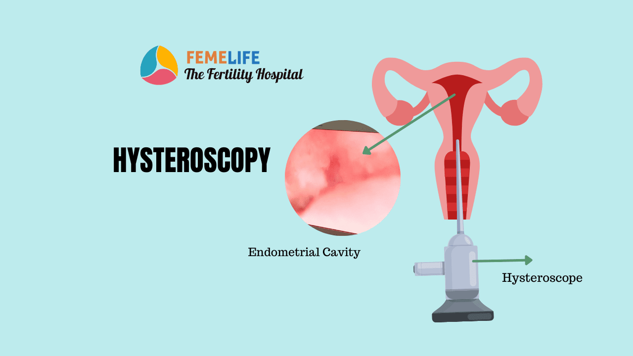 Hysteroscopy: Looking into The Uterus | FEMELIFE