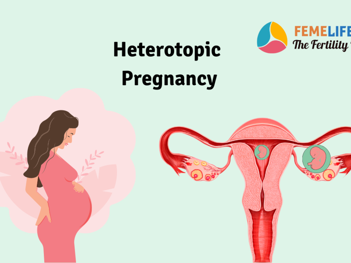 Heterotopic pregnancy