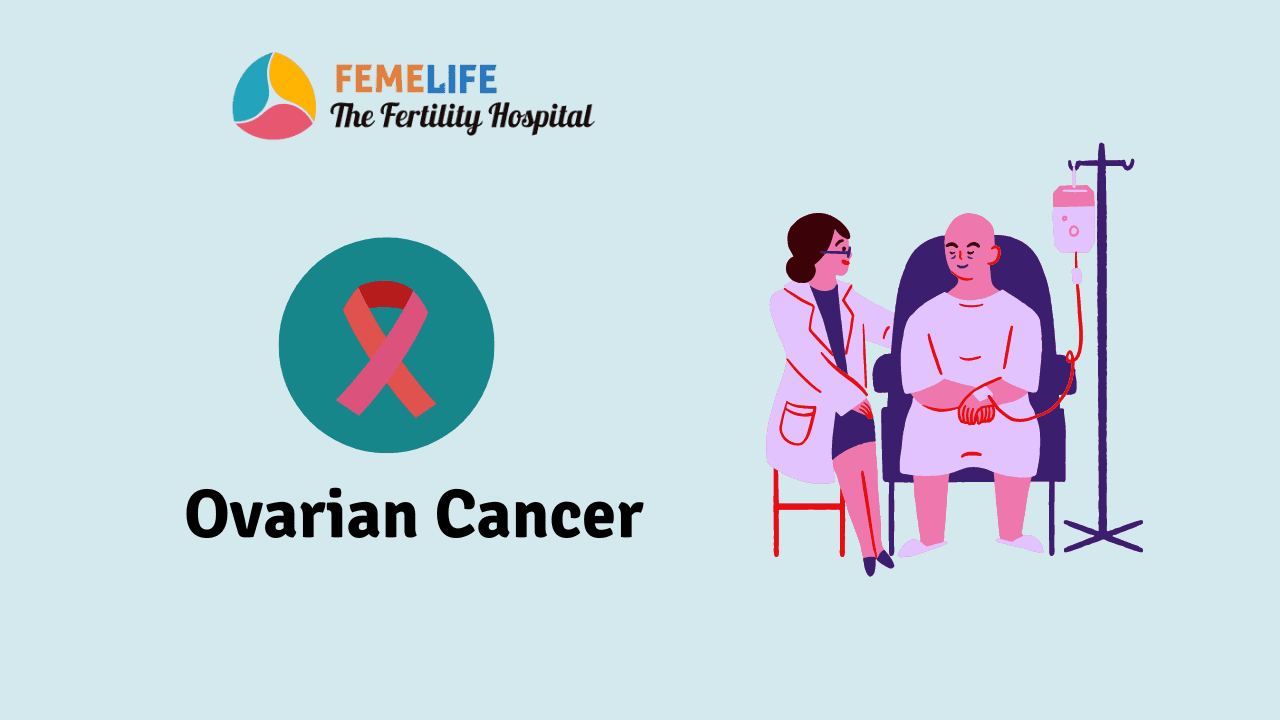 Ovarian Cancer Early Signs And Treatment Femelife 0083