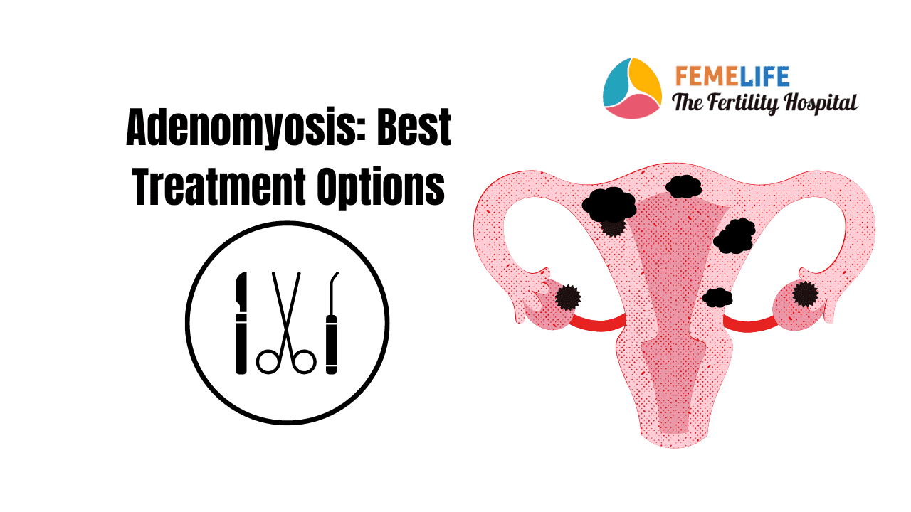 Adenomyosis Uterus: Facts to Know