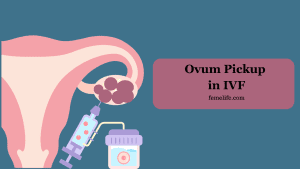 Ovum Pickup in IVF